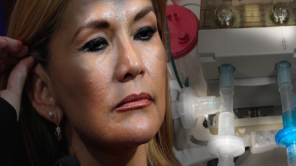 Áñez compró resucitadores por respiradores