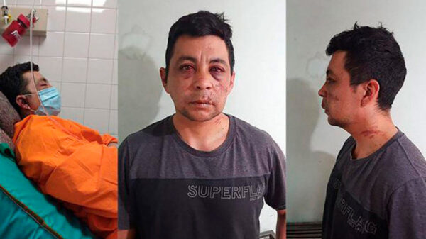 Argentino golpeado salvajemente