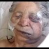 abuela muere prendida en fuego